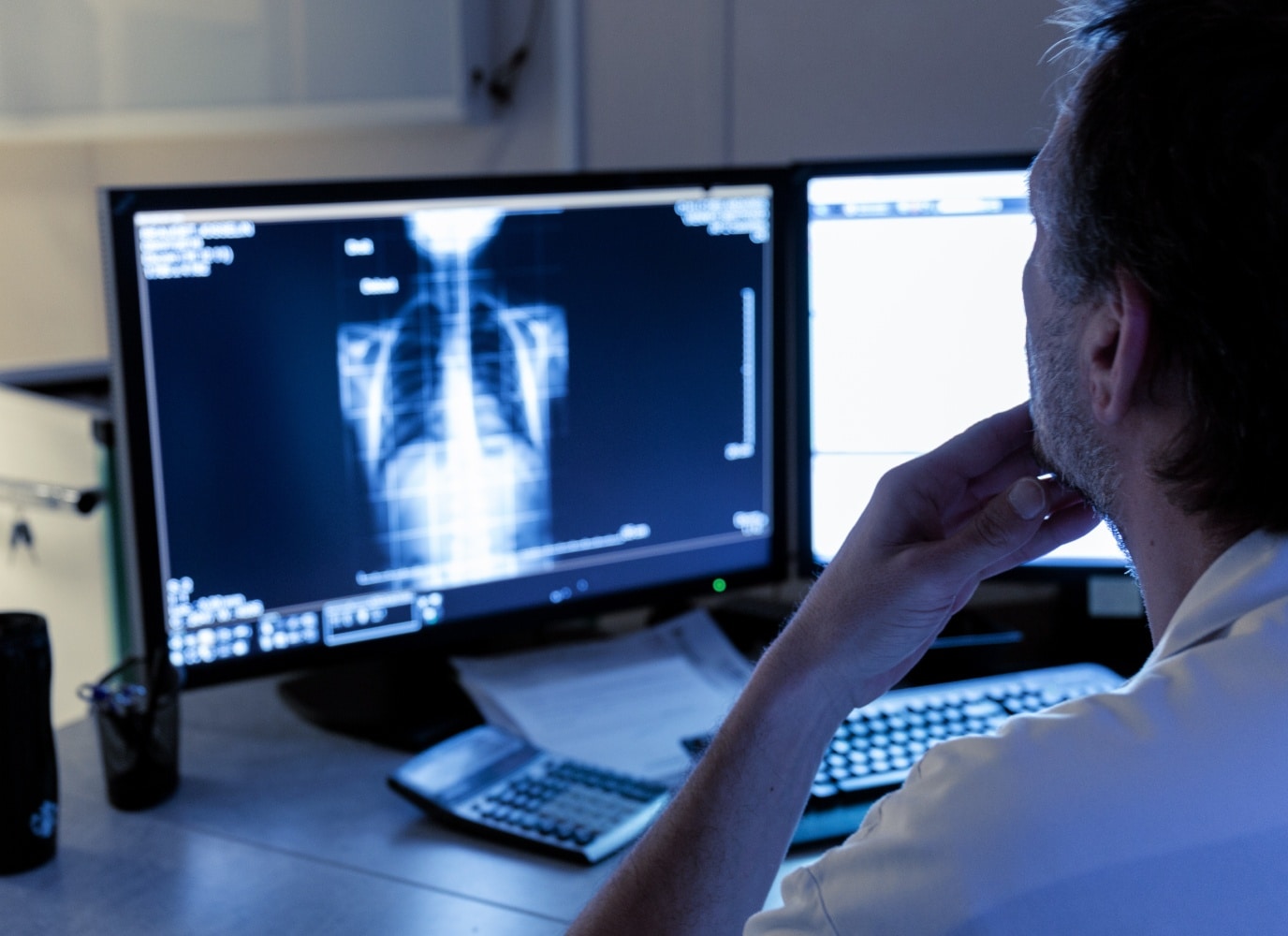 Medecin analyse des radiographie sur ordinateur radiographie pulmonaire | Groupe Revelis